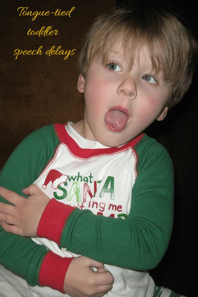 tongue-tied-toddler-speech-delay